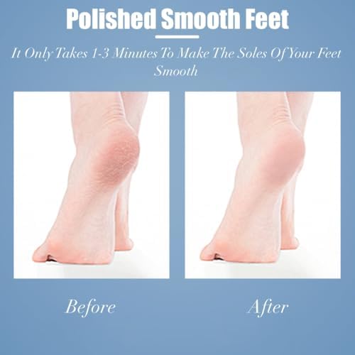 Beyond The Cream Foot File - Gold, Foot Callus Remover, Durable Foot Scrubber, Dead Skin Remover, Hygienic Pedicure Tool, Long Lasting Foot Buffer, Soft Smooth Feet