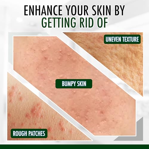 GLY MIRACLE Moisturizing Body Cream Lotion, 16 ounce - Non-Greasy Skin Humectant for Extremely Dry Skin, Hands, Body, and Feet, Fragrance-Free with Pure Glycerin for Nourishing Hydration.