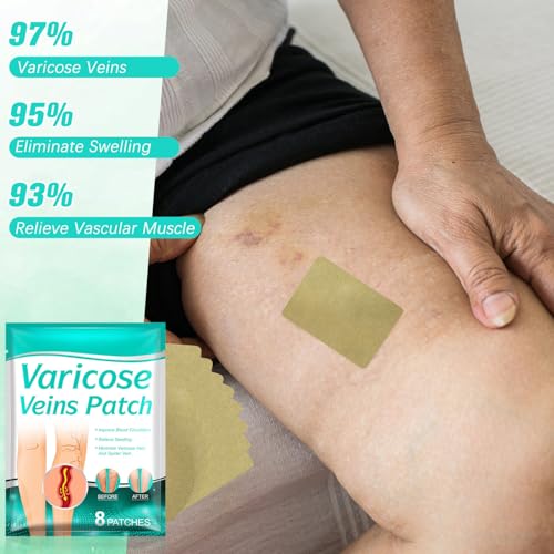 LegRenew Varicose Veins Patch,Professional Relief for Varicose Veins in The Legs，Natural Improvement Spider Veins Patch（2PCS)